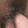 uncut massive genital hair bush